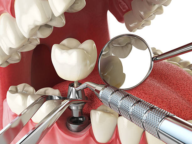 Best Emergency Care for Gum Disease in Middletown, MD